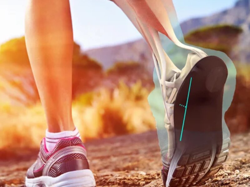 Custom Sole Supports orthotic insole fitting at Absolute Wellness Chiropractic, Peoria IL